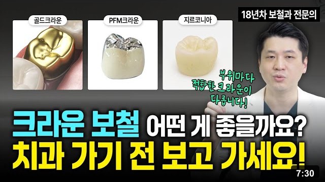 크라운, 어떤 재료가 좋을까요